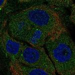 PITPNM1 Antibody in Immunocytochemistry (ICC/IF)