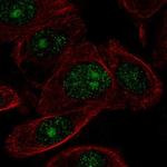 ZNF692 Polyclonal Antibody