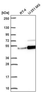 ZNF692 Antibody in Western Blot (WB)