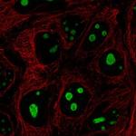 SREK1IP1 Polyclonal Antibody