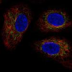 TMEM11 Polyclonal Antibody