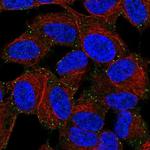 LIMD2 Polyclonal Antibody