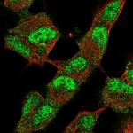 JMJD2B Polyclonal Antibody