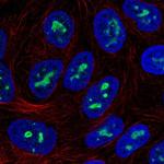 ZNF713 Polyclonal Antibody