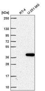 ZNF713 Antibody in Western Blot (WB)