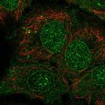 CYP2B6 Polyclonal Antibody