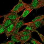 ZNF9 Polyclonal Antibody