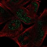 L-Myc Polyclonal Antibody