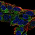 TTC39B Polyclonal Antibody