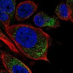 TPRG1L Polyclonal Antibody