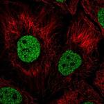 BNC1 Polyclonal Antibody