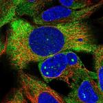 ZNF416 Polyclonal Antibody