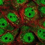 SERTAD1 Antibody in Immunocytochemistry (ICC/IF)