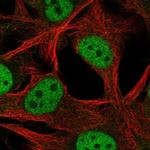 SCML4 Polyclonal Antibody