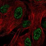 ZNF441 Polyclonal Antibody