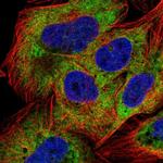 NAA20 Polyclonal Antibody