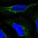 RDH5 Antibody in Immunocytochemistry (ICC/IF)