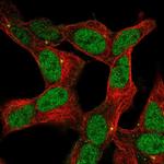 ZNF12 Antibody in Immunocytochemistry (ICC/IF)