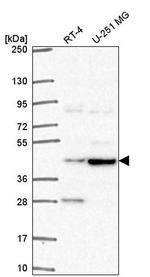 ENTHD2 Antibody in Western Blot (WB)