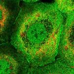 PLEKHG3 Polyclonal Antibody