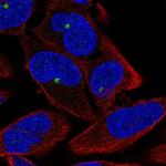 ZNF766 Polyclonal Antibody