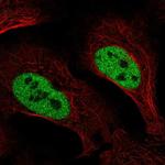 SLC4A3 Polyclonal Antibody