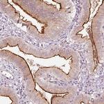 DUOXA2 Antibody in Immunohistochemistry (IHC)