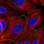 TMEM186 Polyclonal Antibody