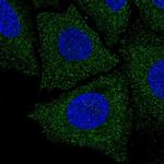LIX1L Polyclonal Antibody