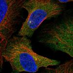 SLAIN2 Antibody in Immunocytochemistry (ICC/IF)
