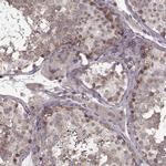 SLAIN2 Antibody in Immunohistochemistry (IHC)