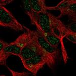 FEM1A Antibody in Immunocytochemistry (ICC/IF)