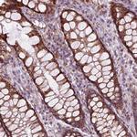 SLC25A24 Antibody in Immunohistochemistry (Paraffin) (IHC (P))