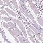 SLC25A24 Antibody in Immunohistochemistry (Paraffin) (IHC (P))