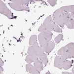SLC25A24 Antibody in Immunohistochemistry (IHC)