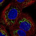 SLC25A24 Polyclonal Antibody