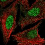 HOXD3 Polyclonal Antibody