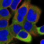 PPP6R1 Polyclonal Antibody