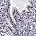 ZNF19 Antibody in Immunohistochemistry (IHC)