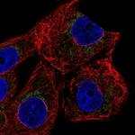 ZNF19 Polyclonal Antibody