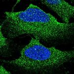 NKCC1 Polyclonal Antibody