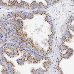 YIPF3 Antibody in Immunohistochemistry (Paraffin) (IHC (P))