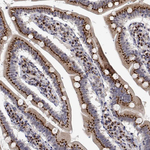 YIPF3 Antibody in Immunohistochemistry (Paraffin) (IHC (P))