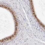 YIPF3 Antibody in Immunohistochemistry (IHC)