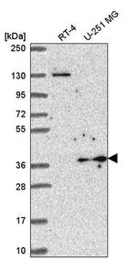 YIPF3 Antibody in Western Blot (WB)