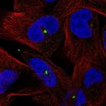 Centrin 3 Polyclonal Antibody