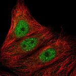 ARMC5 Polyclonal Antibody