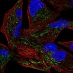 GLRX5 Polyclonal Antibody