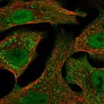 CYP24A1 Polyclonal Antibody