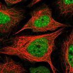 BAZ2A Antibody in Immunocytochemistry (ICC/IF)